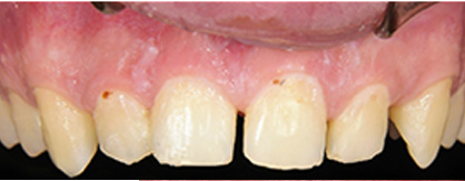 Cosmetic Dentist Astoria