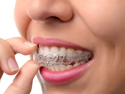 Astoria Modern Family Dental | Pediatric Dentistry, Invisalign reg  and Ceramic Crowns