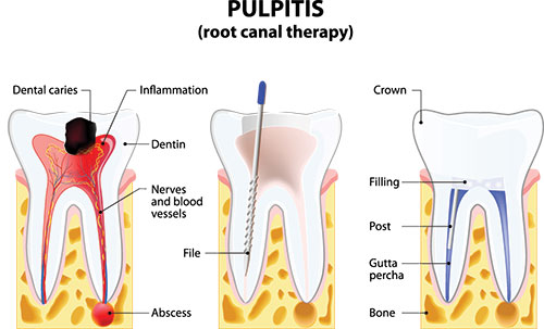 Astoria Modern Family Dental | Oral Exams, Pediatric Dentistry and Oral Cancer Screening